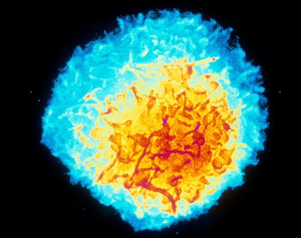 T-limfocit zaražen HIV-om