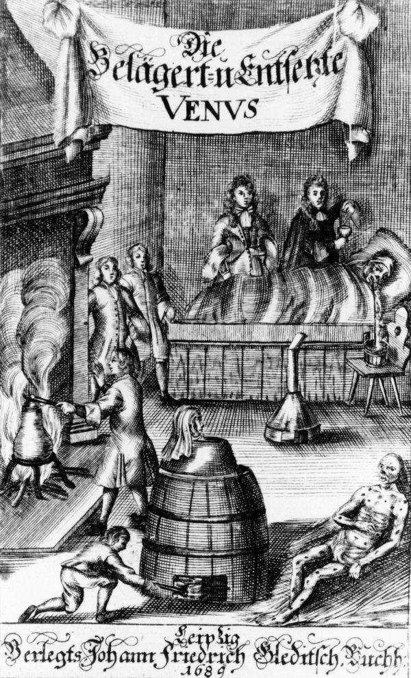 Liječenje sifilisa u 17. stoljeću