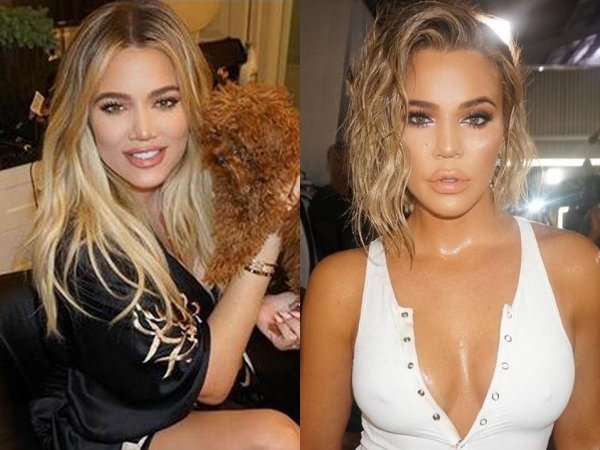 Khloe Kardashian prije i poslije operacije nosa