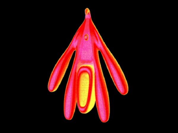 Grafički prikaz klitorisa