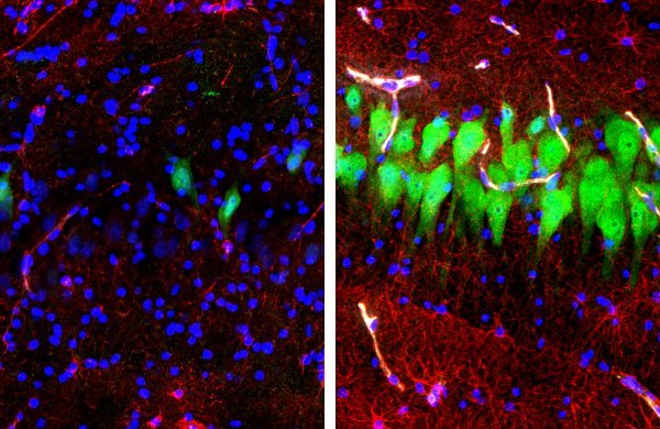 Imunofluorescentna bojanja neurona, astrocita i staničnih jezgara u CA3 regiji hipokampusa mozga 10 sati nakon smrti (lijevo) i mozga tretiranog tehnologijom BrainEx (desno)