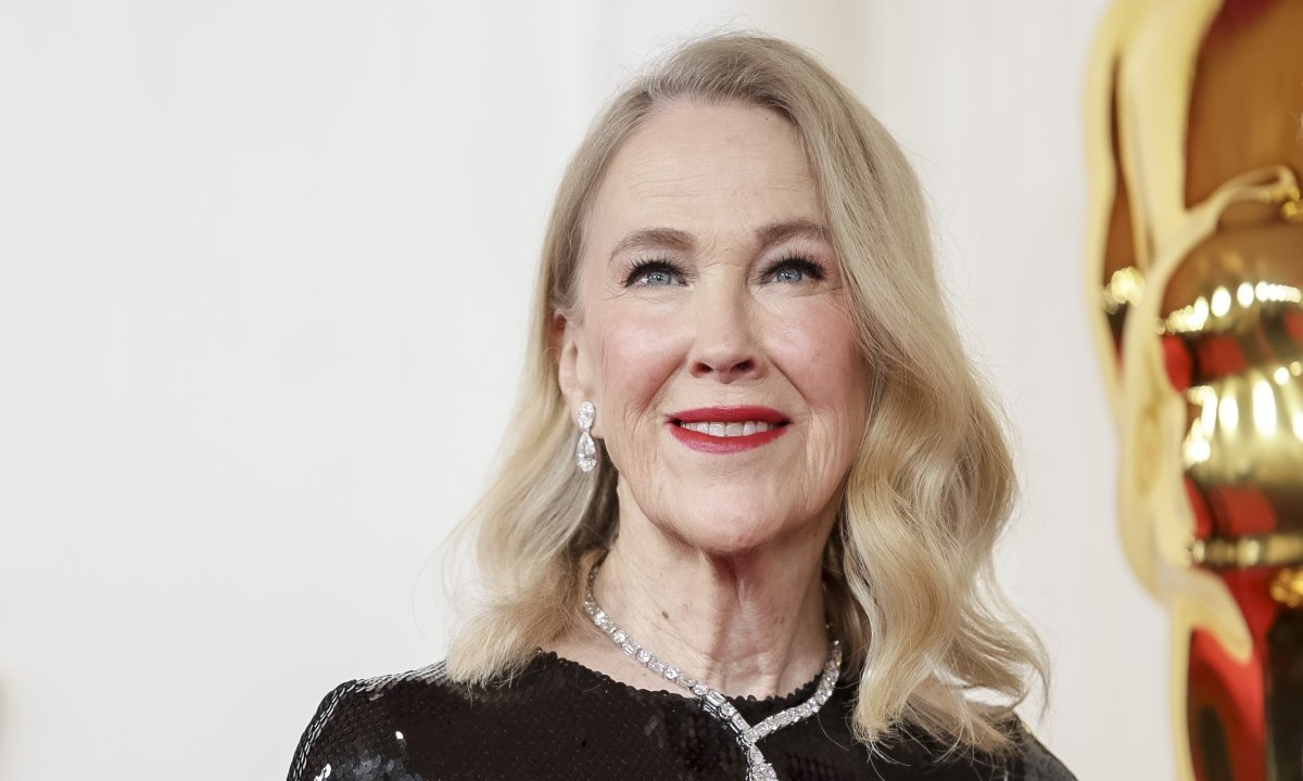 Nije imala pojma da je drukčija: Catherine O'Hara imala je rijetko stanje koje pogađa jednu od 10.000 osoba Kép