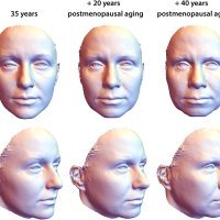 Vizualizacija starenja lica u postmenopauzi