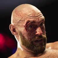Tyson Fury
