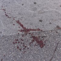 Pula: Muškarac izboden u zgradi u Zadarskoj ulici