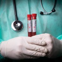 Koronavirus epruvete krv