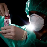 Koronavirus epruvete krv