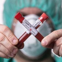 Koronavirus epruvete krv