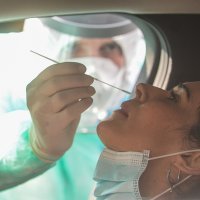 Nastavni zavod za javno zdravstvo "dr. Andija Štampar" uveo "drive in" dijagnostiku koronavirusa