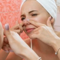 Njega problematične kože