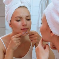 Njega problematične kože