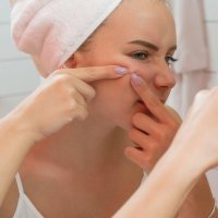 Njega problematične kože