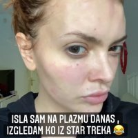 Ella Dvornik - tretman plazmom