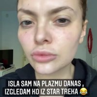 Ella Dvornik - tretman plazmom