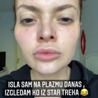 Ella Dvornik - tretman plazmom