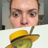 Ella Dvornik - tretman plazmom