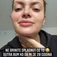 Ella Dvornik - tretman plazmom