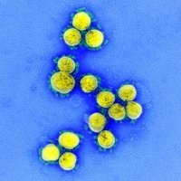 Koronavirus