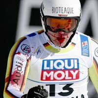 Romed Baumann