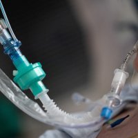 Koronavirus u svijetu