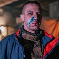 Ranjeni ukrajinski borci u Azovstalu