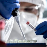 Testiranje na covid-19