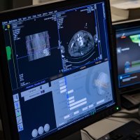 Ablacija i biopsija tumora pomoću robotske ruke u KBC-u Sestre milosrdnice