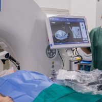 Ablacija i biopsija tumora pomoću robotske ruke u KBC-u Sestre milosrdnice