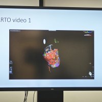 Press-konferecija o uspješno obavljenoj radioablaciji aritmije