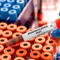 Mononukleoza