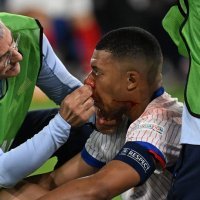 Kylian Mbappe ozljeda, EURO 2024.; 17.6.2024.