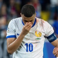 Kylian Mbappe ozljeda, EURO 2024.; 17.6.2024.