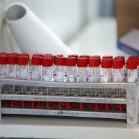 Testiranje na hripavac u Zagrebu