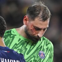 Gianluigi Donnarumma ozljeda