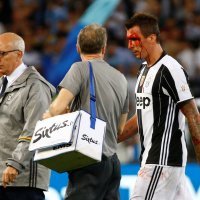 Mario Mandžukić (2)