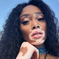 Winnie Harlow