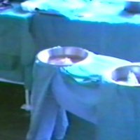 Prva transplantacija srca 1988.