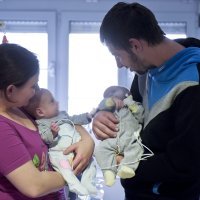 Uspješno razdvojene sijamske blizanke obitelji Tambolaš