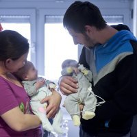 Uspješno razdvojene sijamske blizanke obitelji Tambolaš