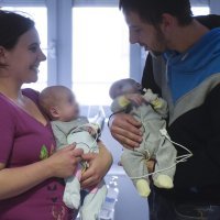 Uspješno razdvojene sijamske blizanke obitelji Tambolaš