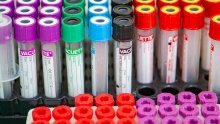 Sedam europskih zemalja kreće s ispitivanjem četiri lijeka za koronavirus na preko tri tisuće pacijenata