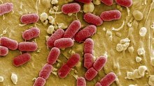 'Završila je era učinkovitih antibiotika'