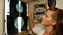 'Ukidanje mamografija je notorna ludost'