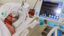 Covid ostavlja ožiljke na bubrežnom tkivu, moguće trajne posljedice