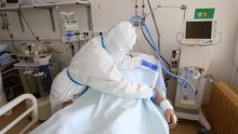 Troškovnik liječenja osoba s koronom; najskuplji je ECMO, a liječnje na respiratoru iznosi 126.592 kune