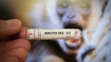 Počelo cijepljenje protiv majmunskih boginja u Europi; zalihe cjepiva su ograničene