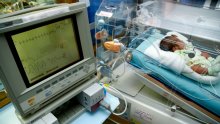 Stopa dojenačke smrtnosti u Hrvatskoj i dalje u padu, najčešći uzrok smrti patološka stanja vezana uz trudnoću