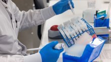 U Hrvatskoj 62 nova slučaja koronavirusa, umrle dvije osobe