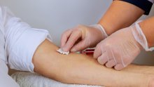 Kad je dobio dijagnozu, doktor mu je rekao: 'Zajedno ćemo doživjeti da se HIV može izliječiti'; sad se to i dogodilo