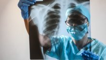 Rijetka gljivična infekcija u SAD-u uzela prvu žrtvu među oboljelima u tvornici papira